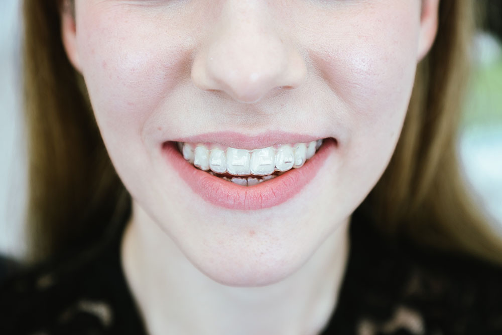 Dijagnostički pregled za ortodontsku terapiju u Orto Novi