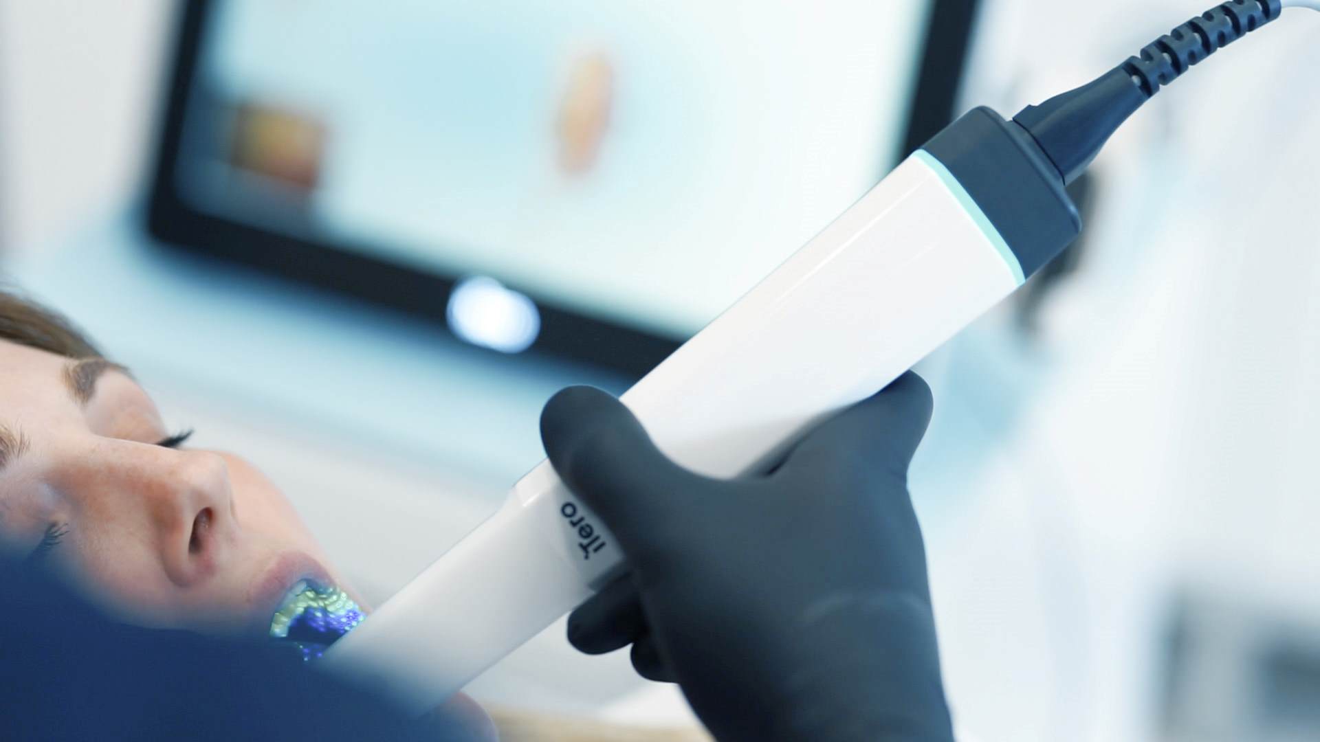 Digitalna stomatološka oprema Orto Nova