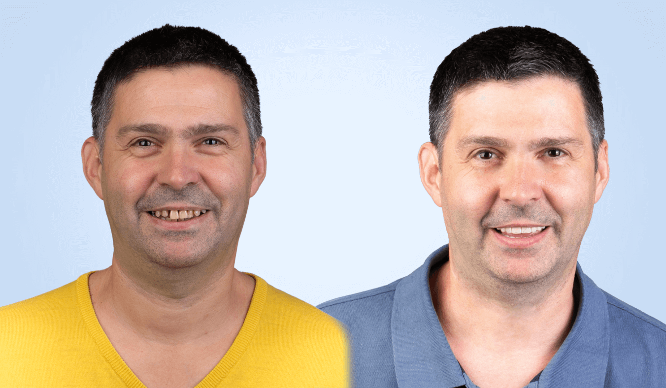 Client before-after all on 4