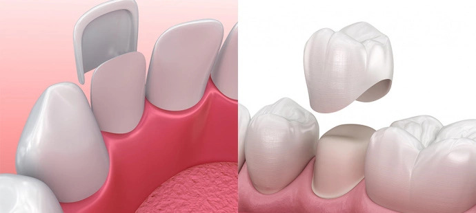 Krunice-ili-ljuskice